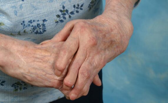 Cómo aliviar el dolor de articulaciones de forma natural