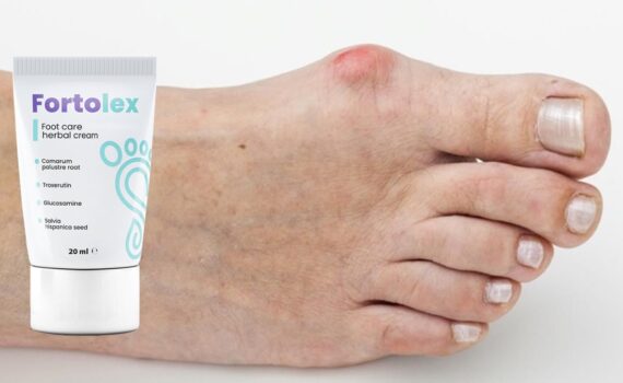 Fortolex crema opiniones reseña comentarios